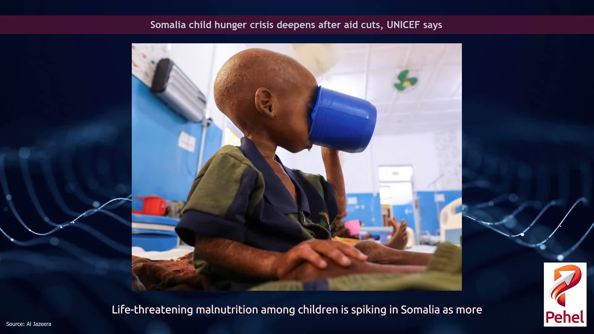 Somalia child hunger crisis deepens after aid cuts, UNICEF says