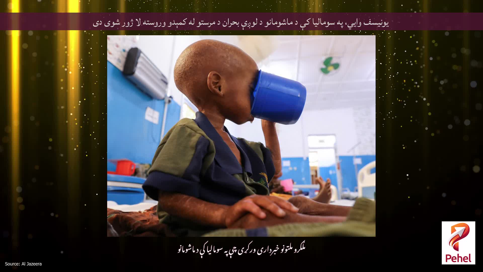 یونیسف وايي، په سومالیا کې د ماشومانو د لوږې بحران د مرستو له کمېدو وروسته لا ژور شوی دی