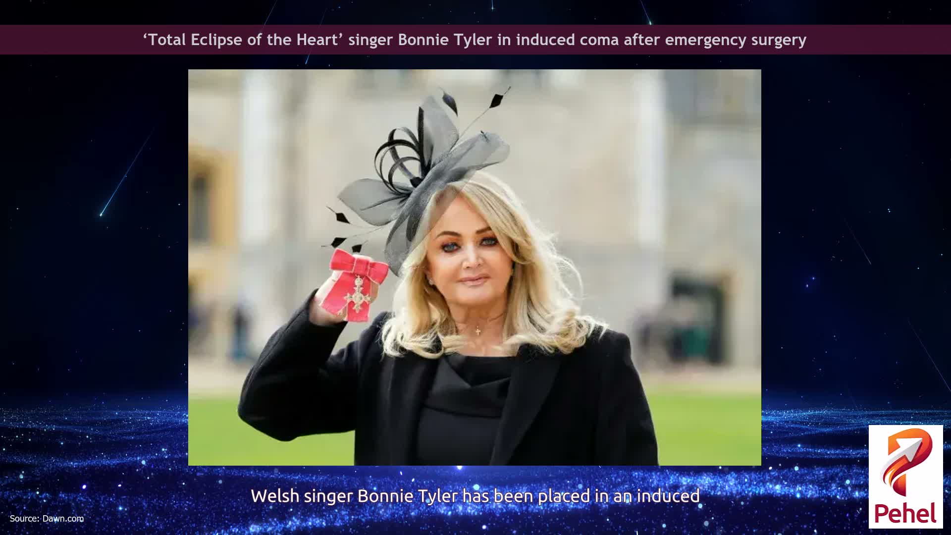 ‘Total Eclipse of the Heart’ singer Bonnie Tyler in induced coma after emergency surgery