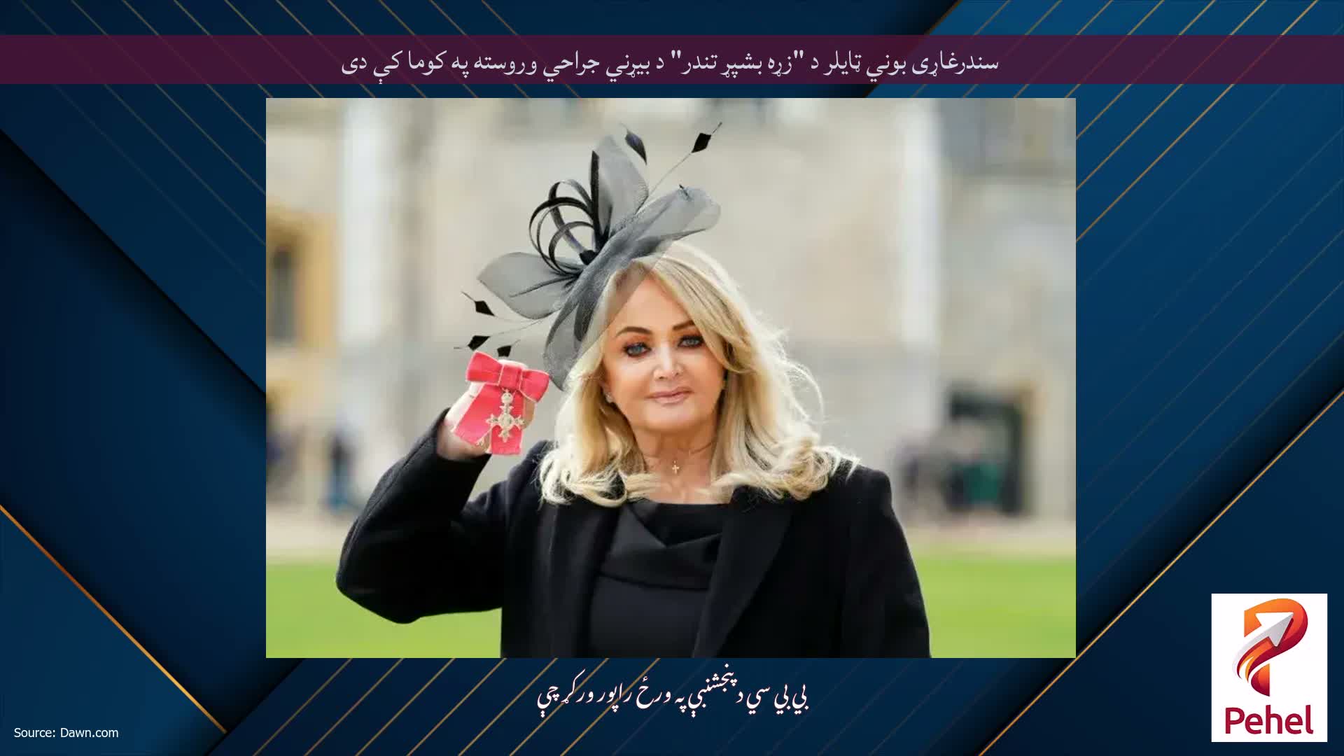سندرغاړی بوني ټایلر د "زړه بشپړ تندر" د بیړني جراحي وروسته په کوما کې دی