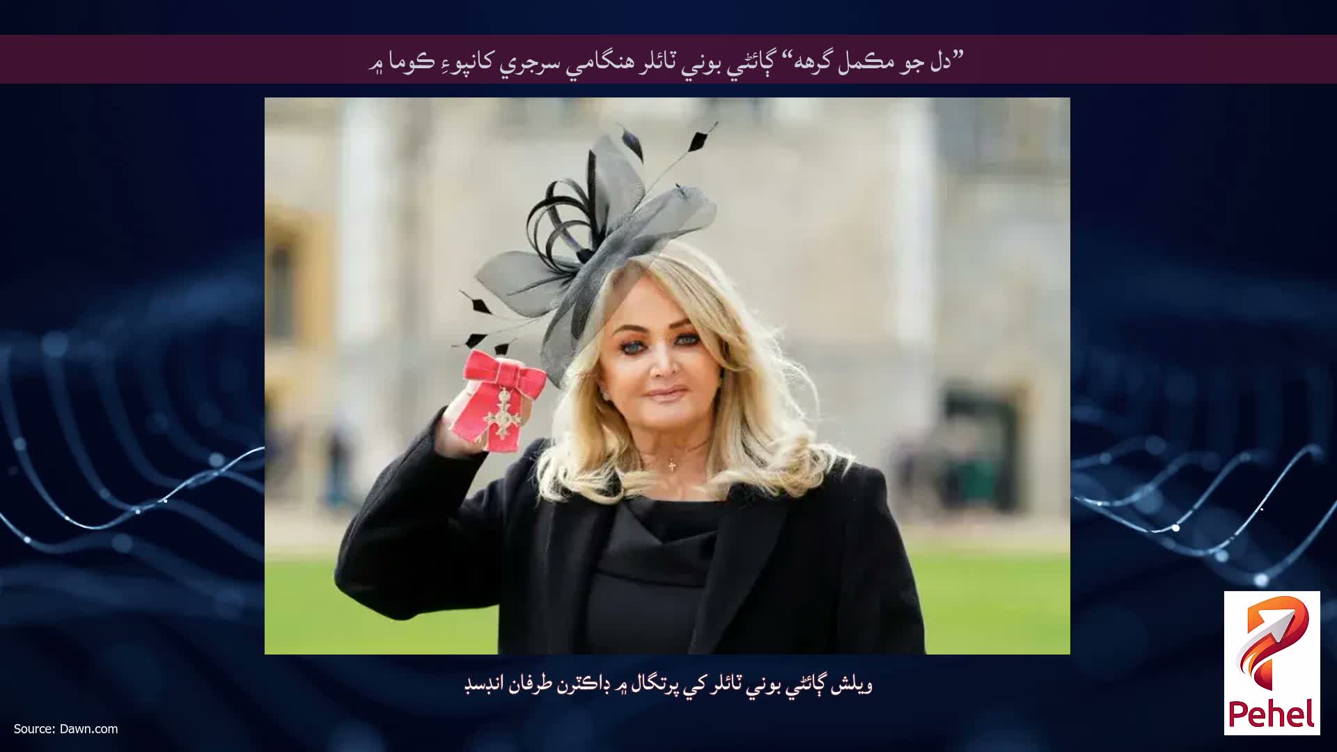 ”دل جو مڪمل گرهه“ ڳائڻي بوني ٽائلر هنگامي سرجري کانپوءِ ڪوما ۾