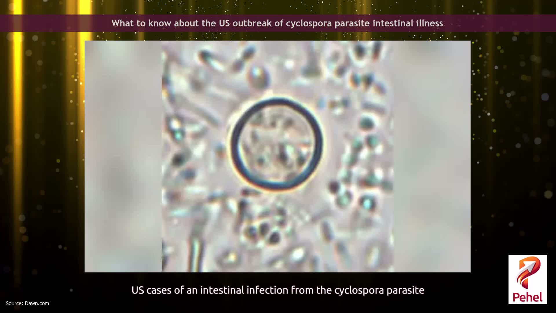 What to know about the US outbreak of cyclospora parasite intestinal illness