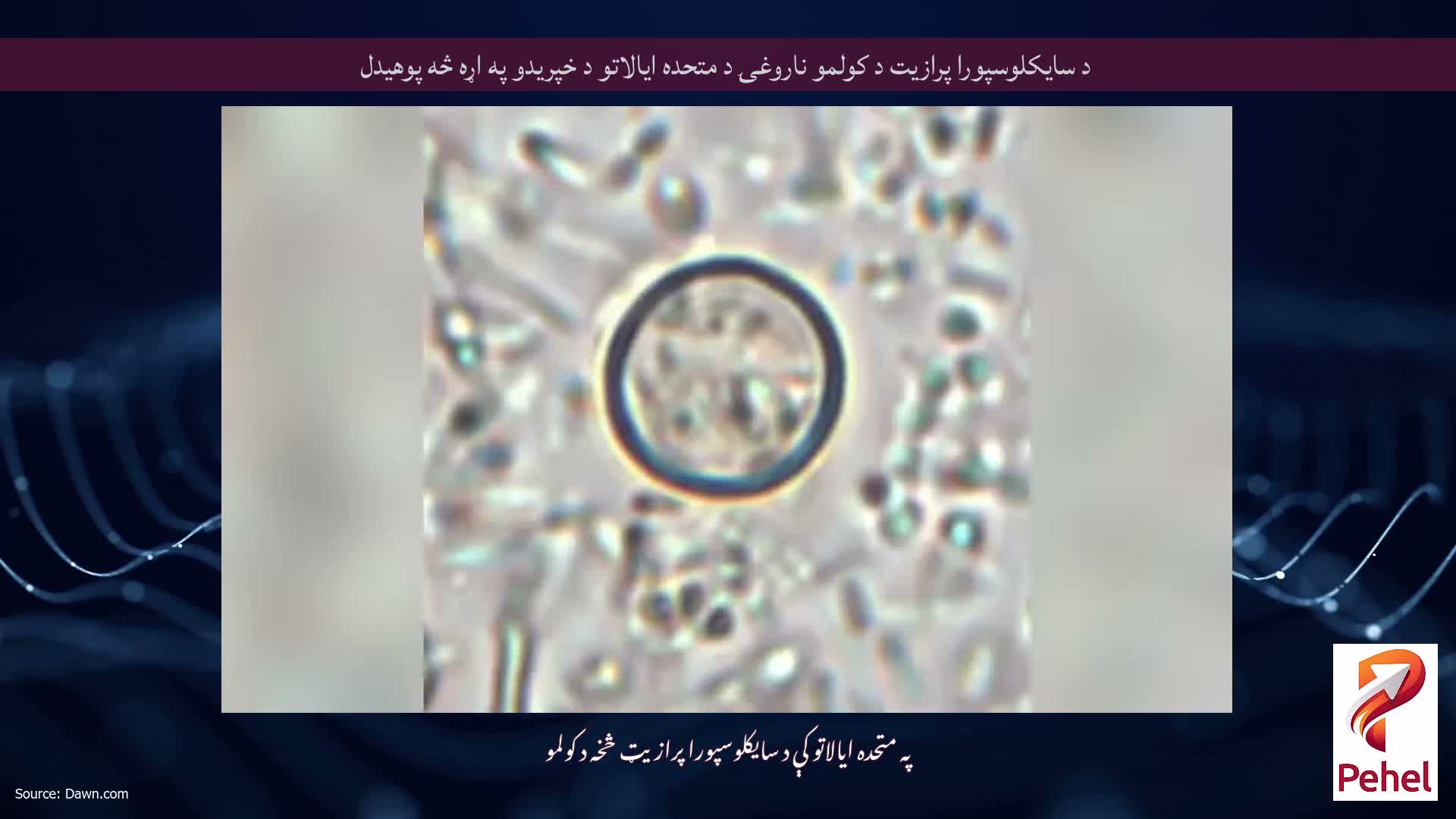 د سایکلوسپورا پرازیت د کولمو ناروغۍ د متحده ایالاتو د خپریدو په اړه څه پوهیدل