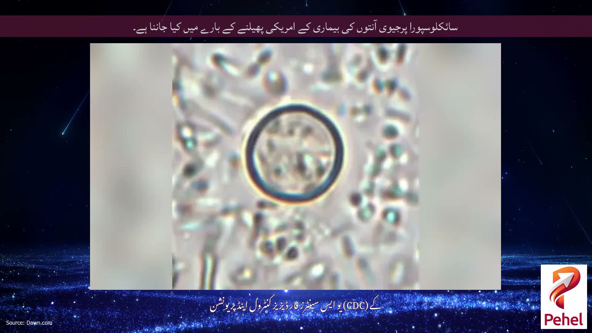 سائکلوسپورا پرجیوی آنتوں کی بیماری کے امریکی پھیلنے کے بارے میں کیا جاننا ہے۔