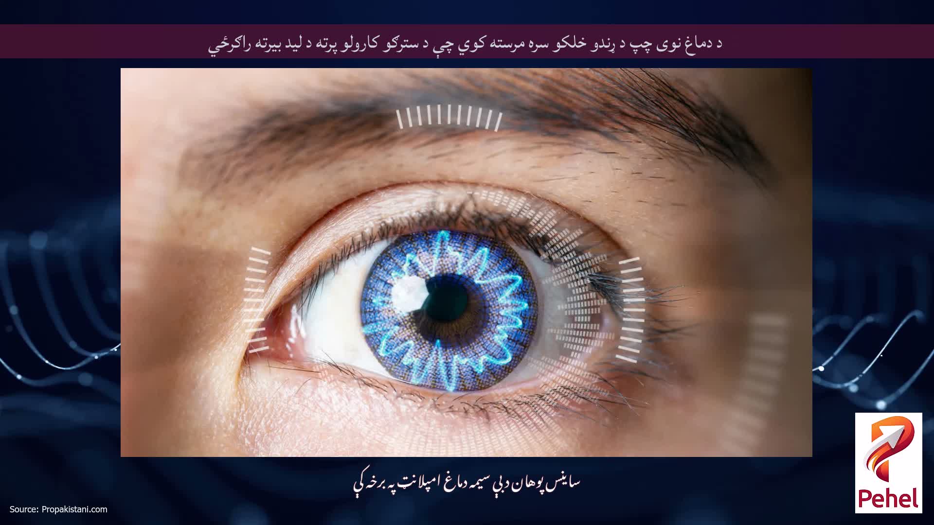 د دماغ نوی چپ د ړندو خلکو سره مرسته کوي چې د سترګو کارولو پرته د لید بیرته راګرځي
