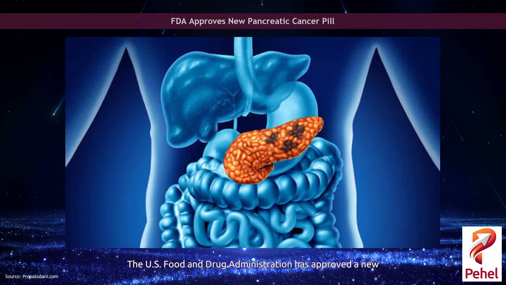 FDA Approves New Pancreatic Cancer Pill