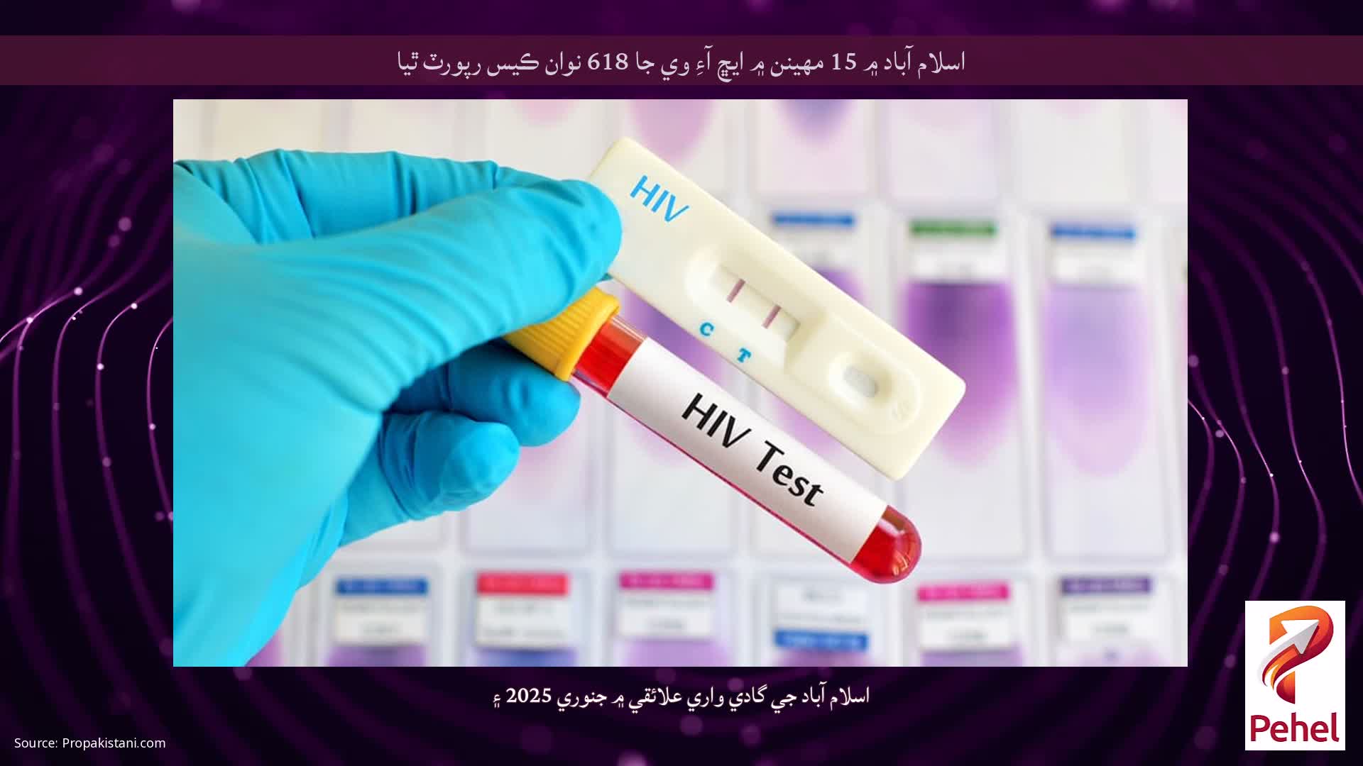 اسلام آباد ۾ 15 مهينن ۾ ايڇ آءِ وي جا 618 نوان ڪيس رپورٽ ٿيا