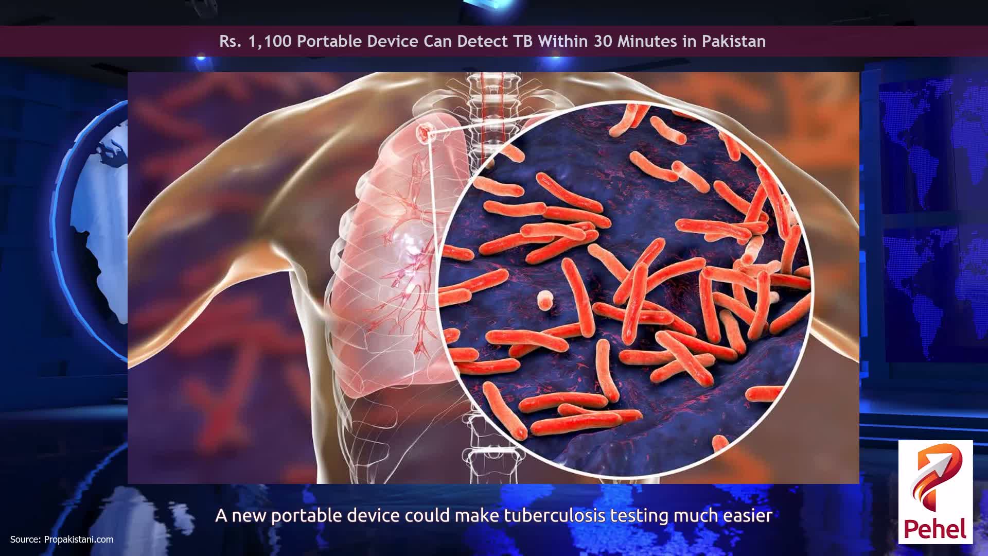 Rs. 1,100 Portable Device Can Detect TB Within 30 Minutes in Pakistan