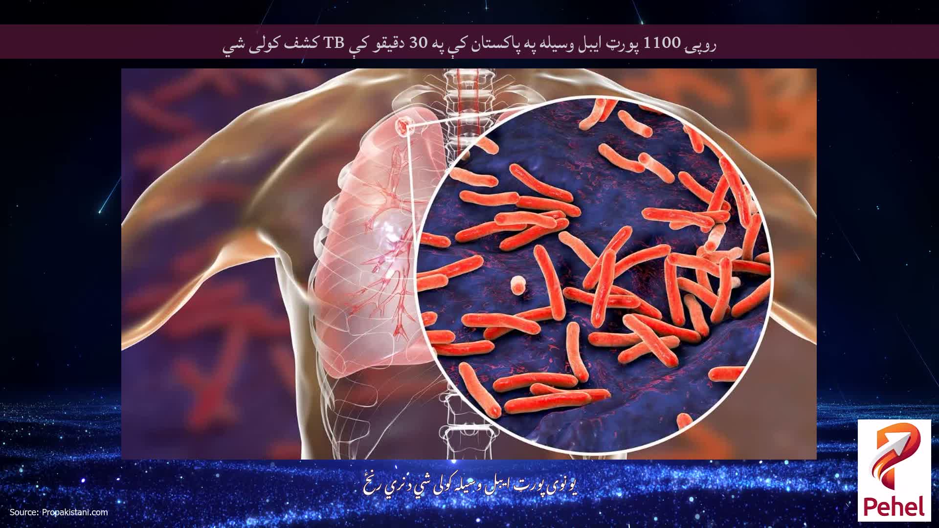 روپۍ 1100 پورټ ایبل وسیله په پاکستان کې په 30 دقیقو کې TB کشف کولی شي
