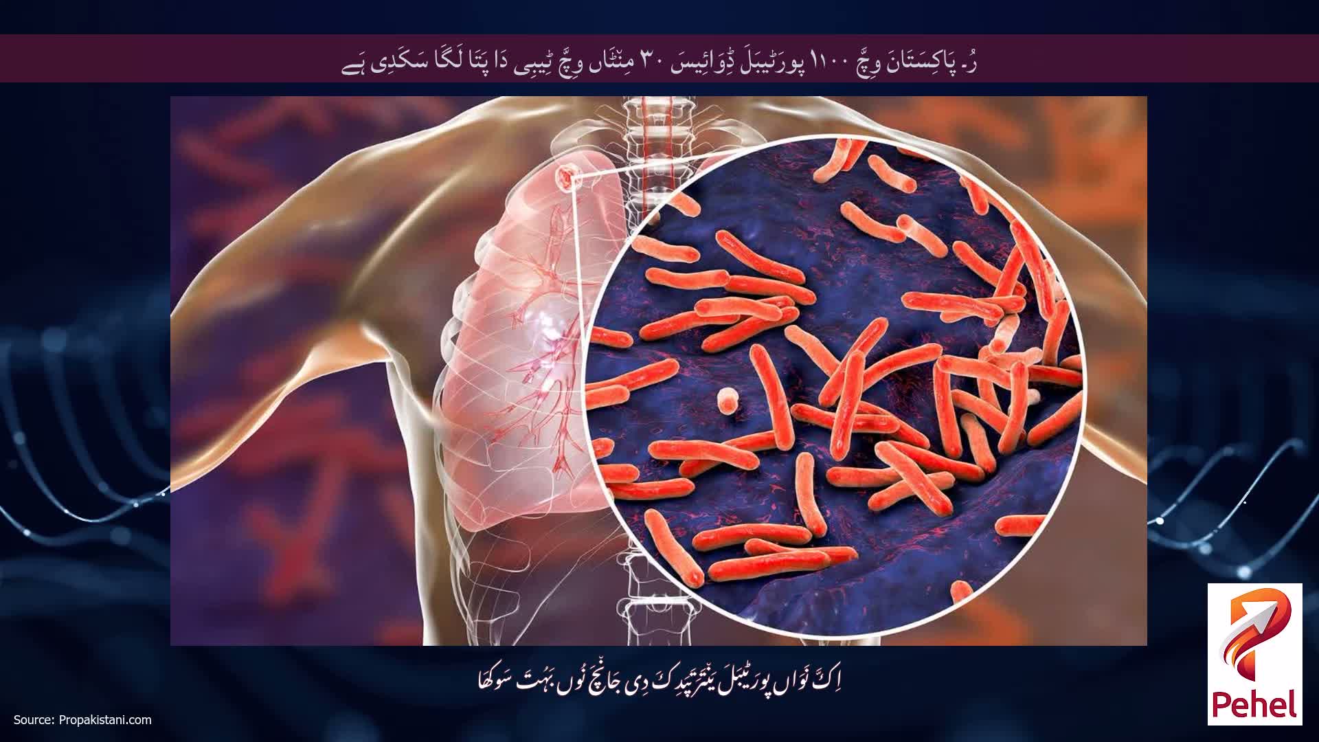 رُ۔ پَاکِسَتَانَ وِچَّ ۱۱۰۰ پورَٹیبَلَ ڈِوَائِیسَ ۳۰ مِن٘ٹَاں وِچَّ ٹِیبِی دَا پَتَا لَگَا سَکَدِی ہَے