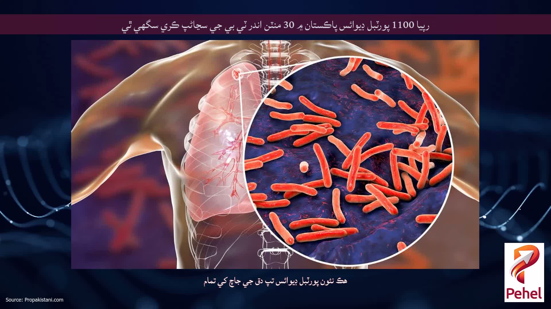 رپيا 1100 پورٽبل ڊيوائس پاڪستان ۾ 30 منٽن اندر ٽي بي جي سڃاڻپ ڪري سگهي ٿي