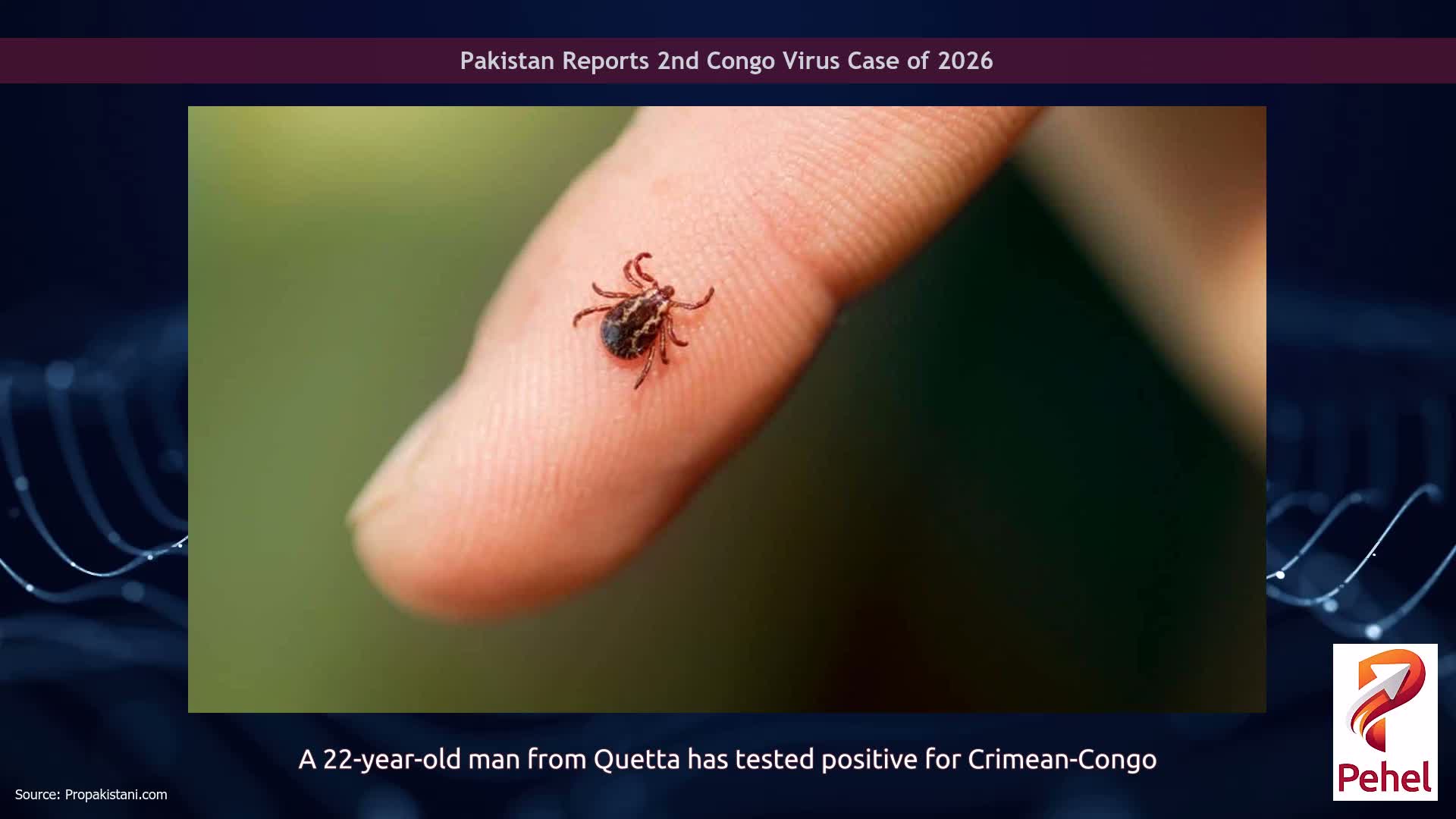 Pakistan Reports 2nd Congo Virus Case of 2026