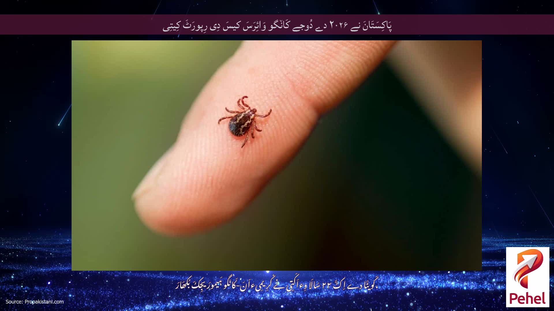 پَاکِسَتَانَ نے ۲۰۲۶ دے دُوجے کَان٘گو وَائِرَسَ کیسَ دِی رِپورَٹَ کِیتِی