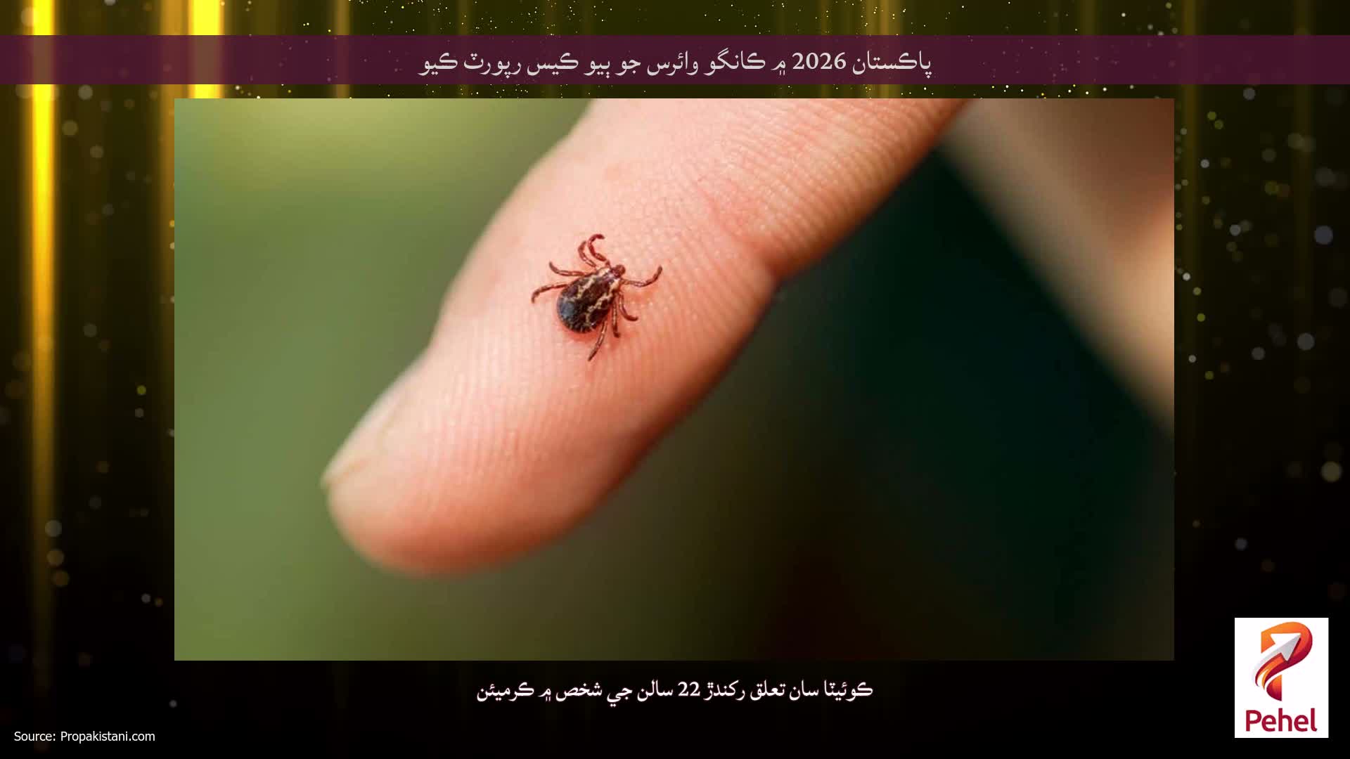 پاڪستان 2026 ۾ ڪانگو وائرس جو ٻيو ڪيس رپورٽ ڪيو