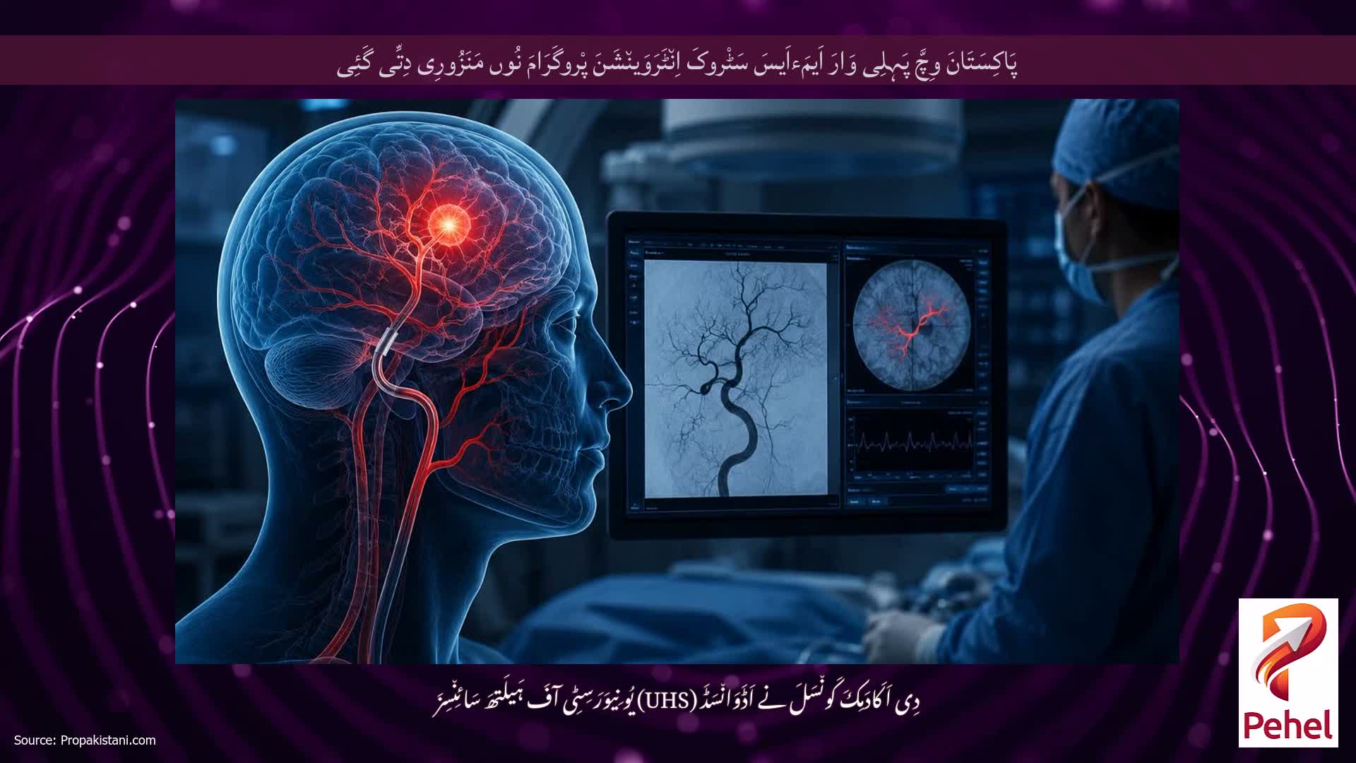 پَاکِسَتَانَ وِچَّ پَہِلِی وَارَ اَیمَءاَیسَ سَٹْروکَ اِن٘ٹَرَوَین٘شَنَ پْروگَرَامَ نُوں مَنَزُورِی دِتِّی گَئِی