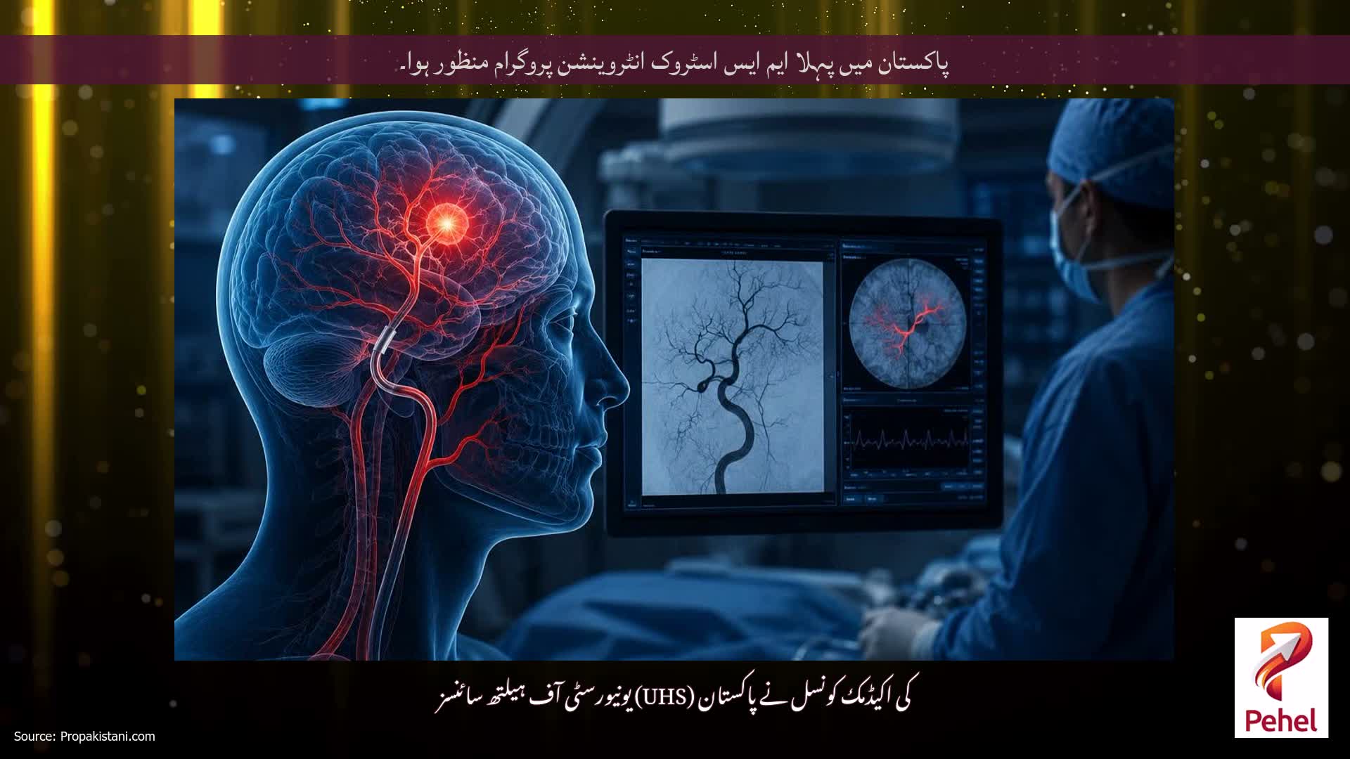 پاکستان میں پہلا ایم ایس اسٹروک انٹروینشن پروگرام منظور ہوا۔