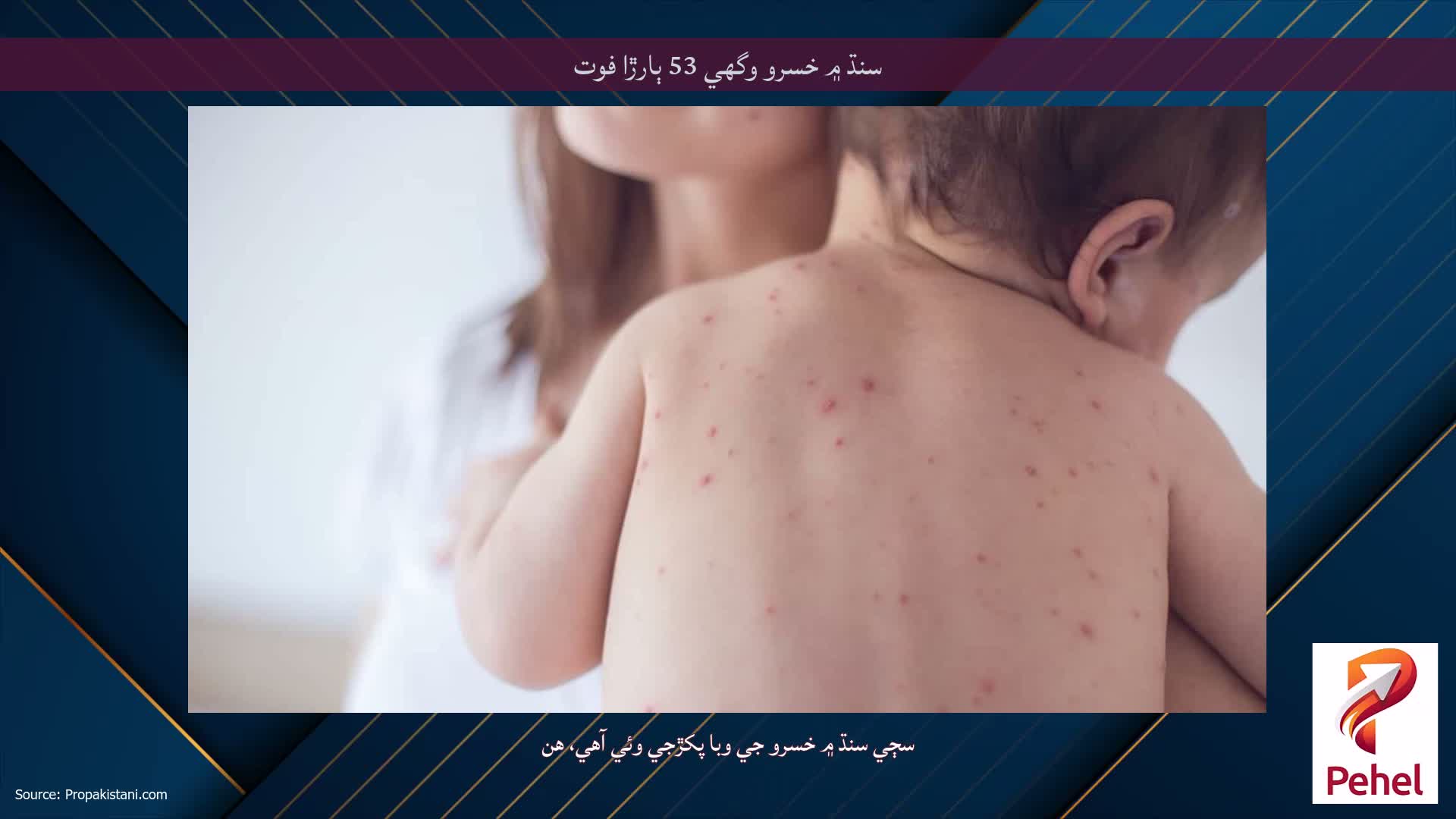 سنڌ ۾ خسرو وگهي 53 ٻارڙا فوت