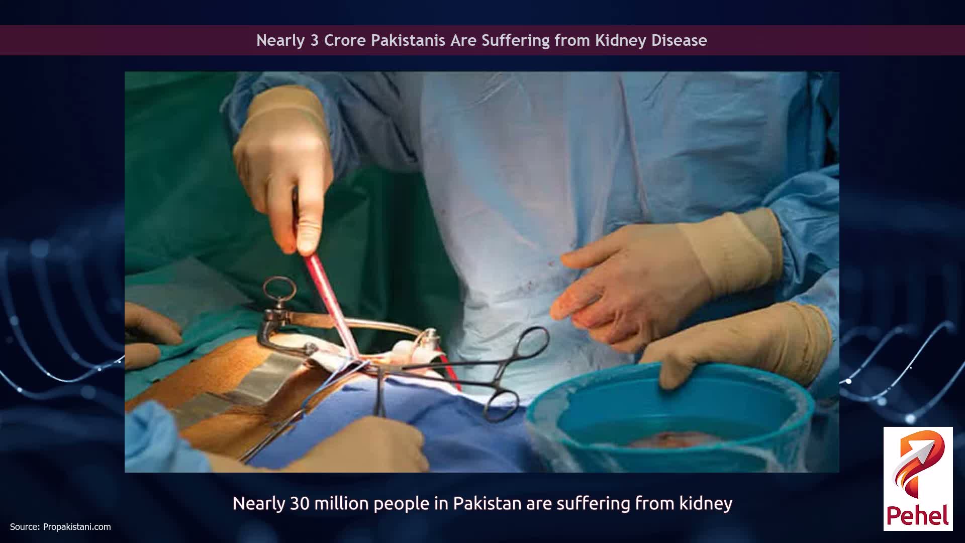 Nearly 3 Crore Pakistanis Are Suffering from Kidney Disease