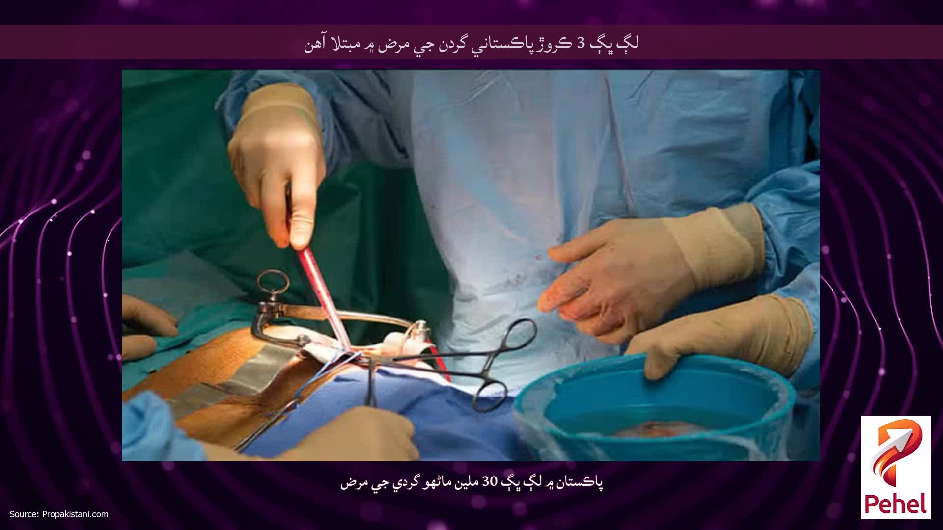 لڳ ڀڳ 3 ڪروڙ پاڪستاني گردن جي مرض ۾ مبتلا آهن
