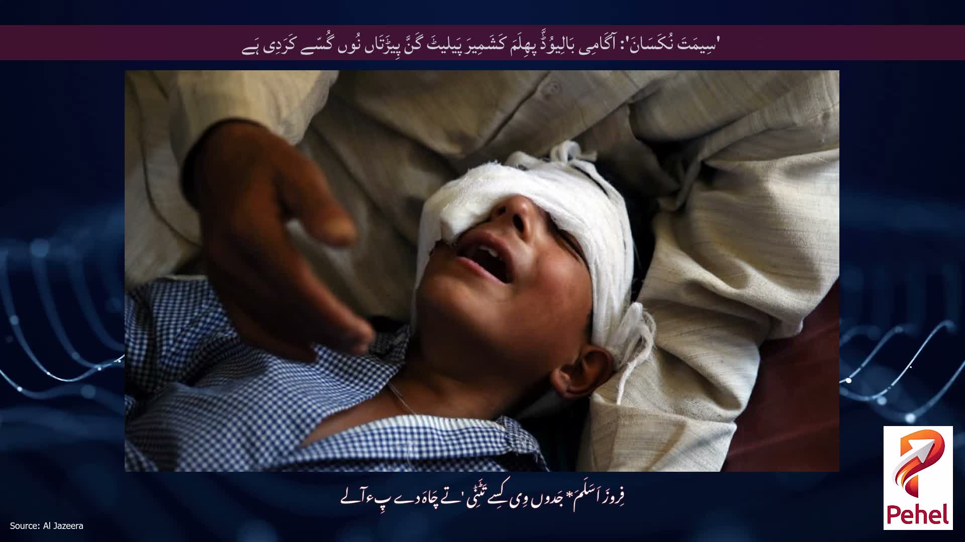 'سِیمَتَ نُکَسَانَ': آگَامِی بَالِیوُڈَّ پھِلَمَ کَشَمِیرَ پَیلیٹَ گَنَّ پِیڑَتَاں نُوں گُسّے کَرَدِی ہَے
