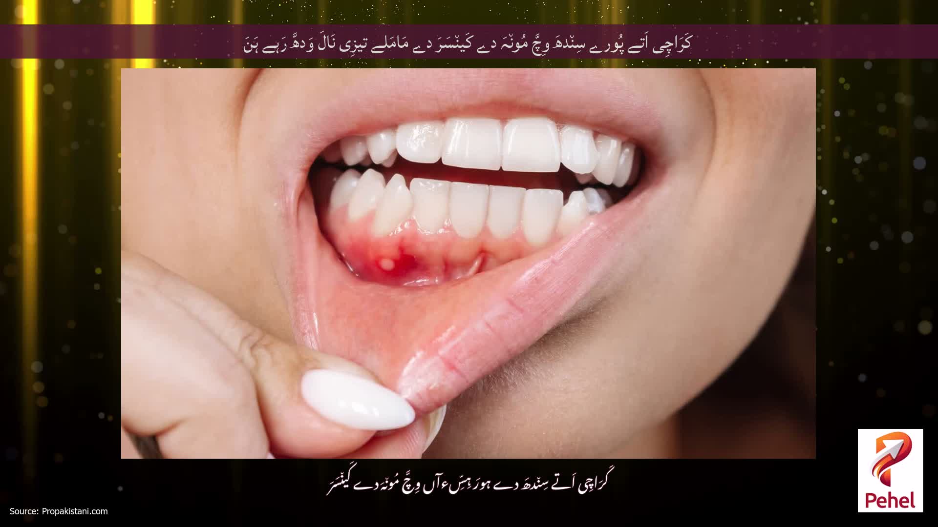 کَرَاچِی اَتے پُورے سِن٘دھَ وِچَّ مُون٘ہَ دے کَین٘سَرَ دے مَامَلے تیزِی نَالَ وَدھَّ رَہے ہَنَ