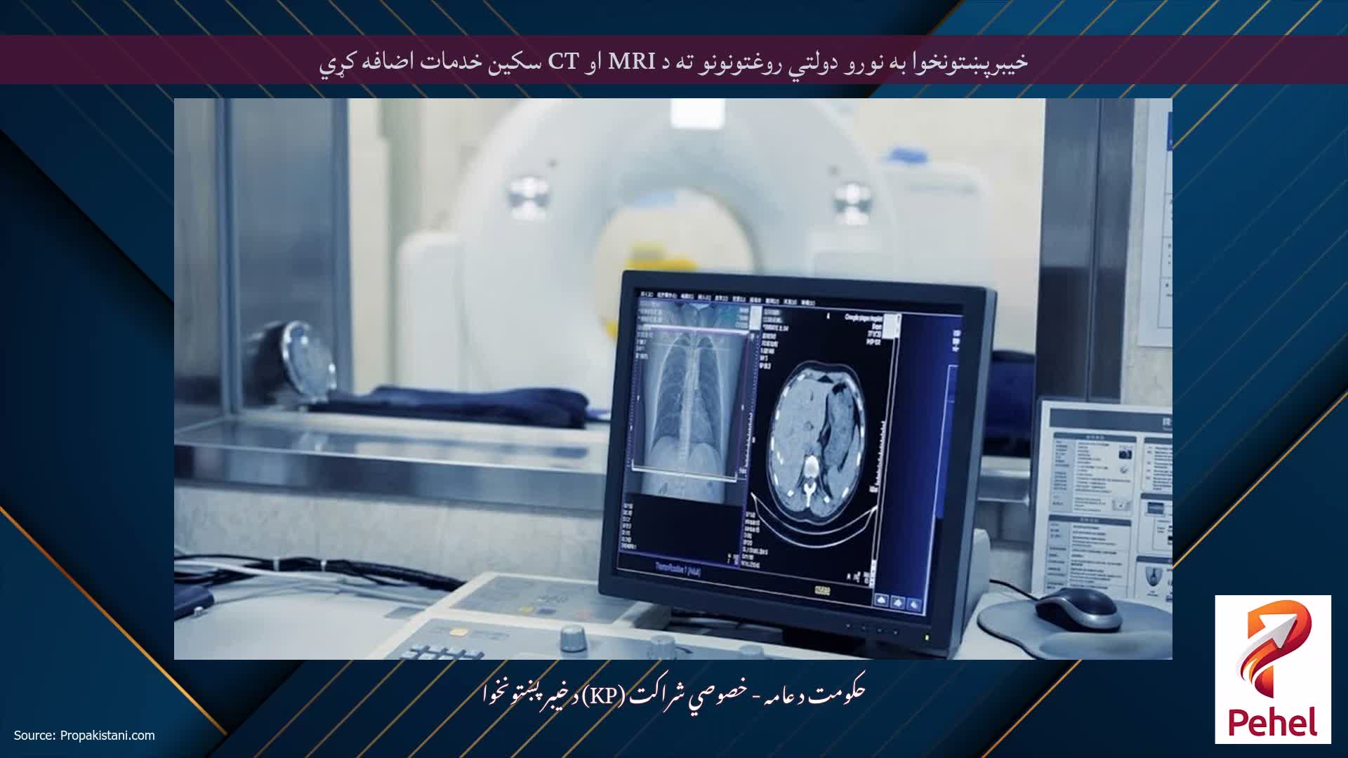 خیبرپښتونخوا به نورو دولتي روغتونونو ته د MRI او CT سکین خدمات اضافه کړي