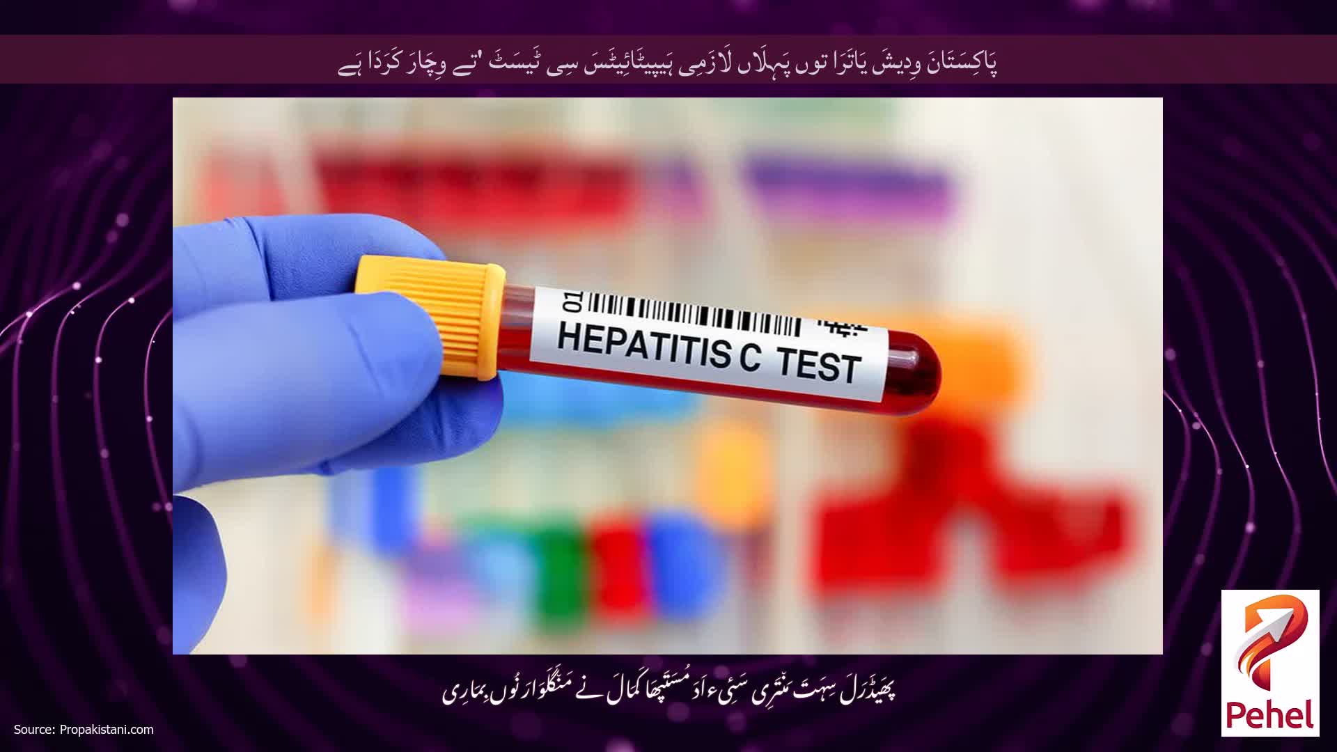 پَاکِسَتَانَ وِدیشَ یَاتَرَا توں پَہِلَاں لَازَمِی ہَیپیٹَائِیٹَسَ سِی ٹَیسَٹَ 'تے وِچَارَ کَرَدَا ہَے