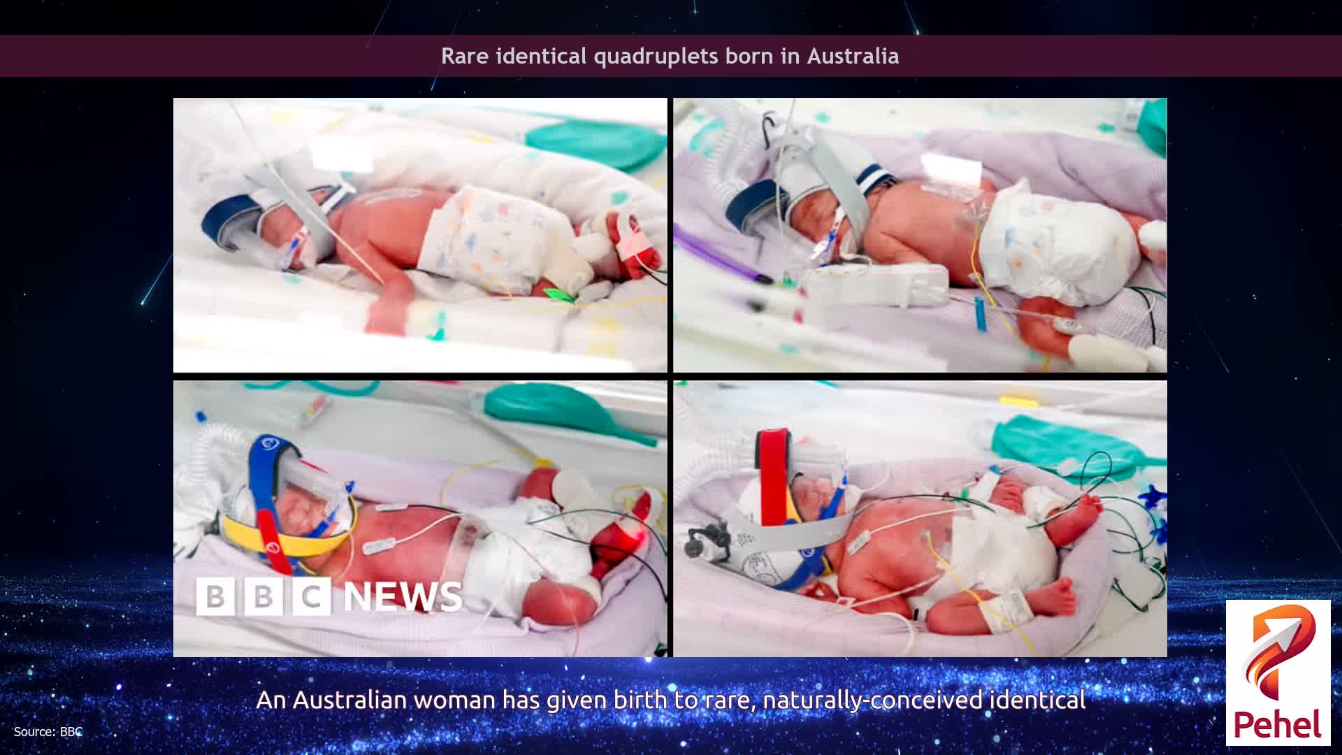 Rare identical quadruplets born in Australia