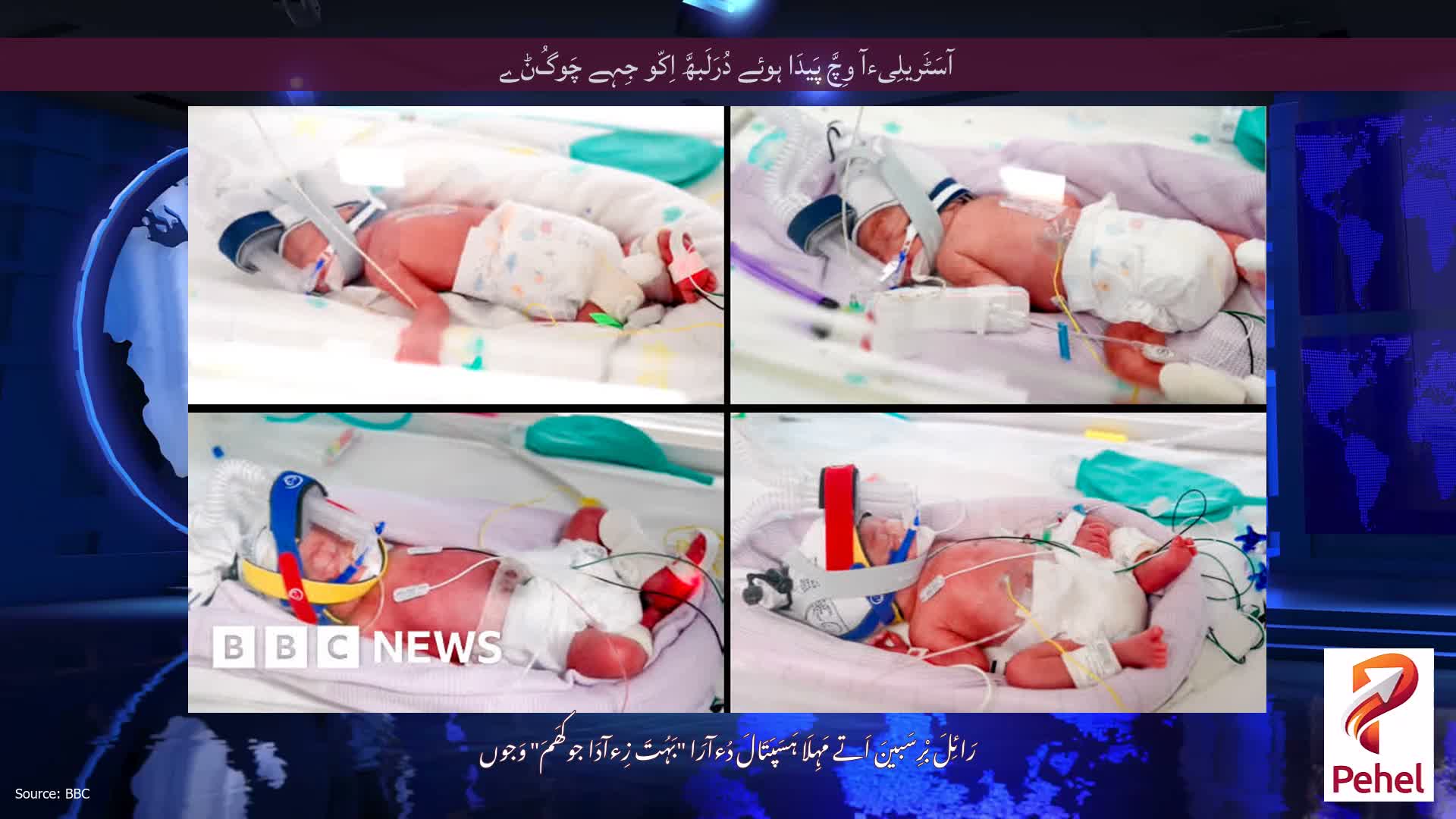 آسَٹَریلِیءآ وِچَّ پَیدَا ہوئے دُرَلَبھَّ اِکّو جِہے چَوگُݨے